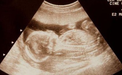 2026厦门私立试管医院排名前四的有哪些？附详细成功率和费用分享