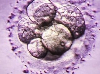 2026俄罗斯试管婴儿大概需要多少费用？