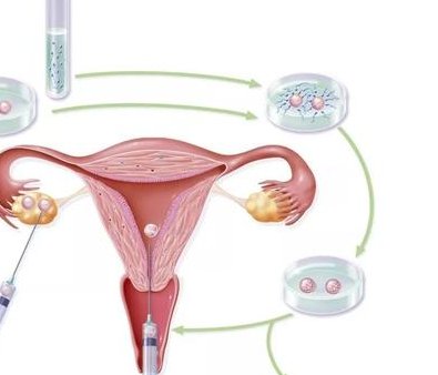 2026大连市三代试管助孕技术哪家强？成功率对比